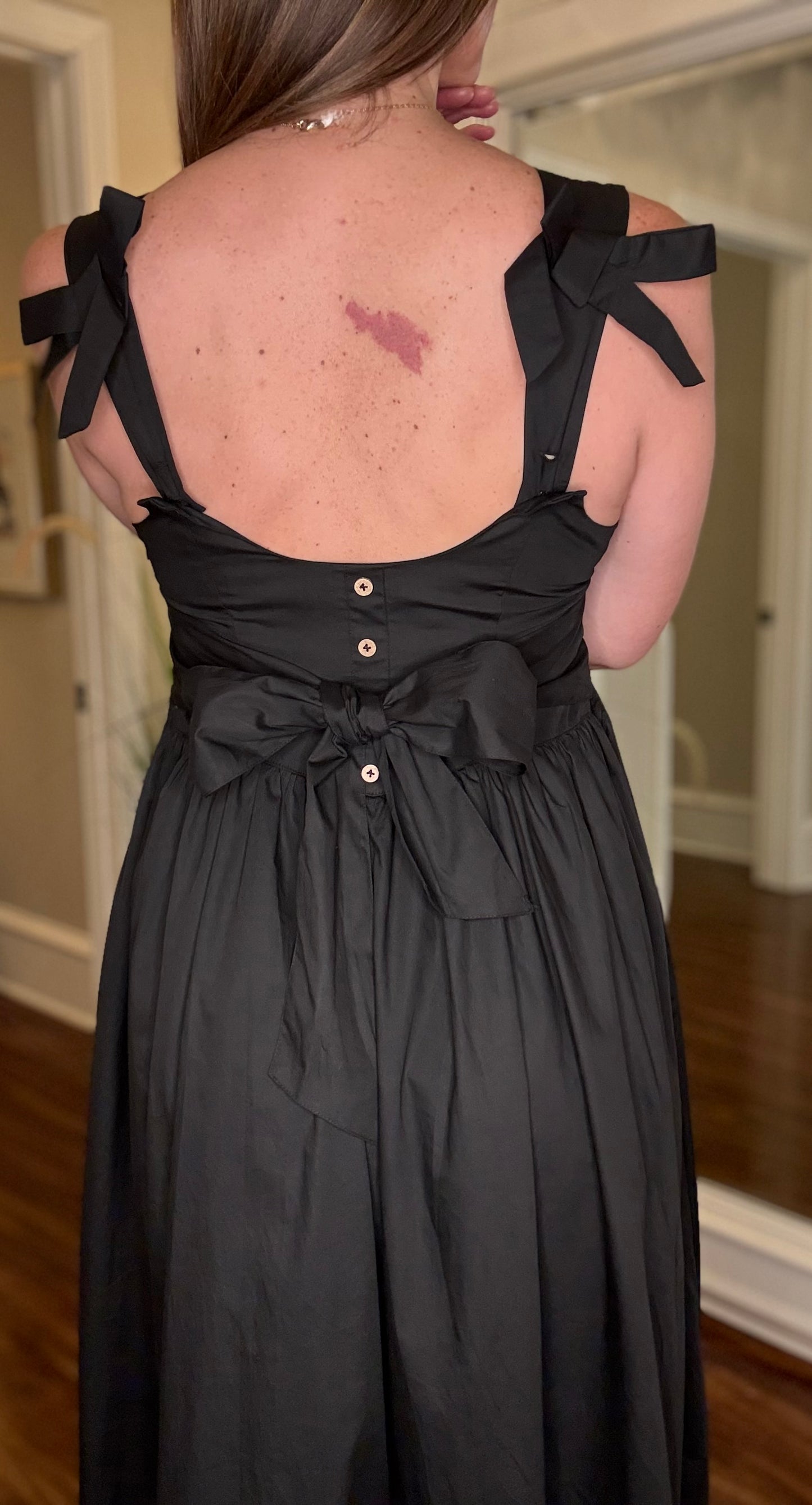 MIOU MUSE BOW DETAIL WOVEN DRESS 5.6